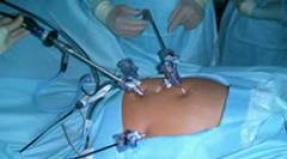 Кому нельзя делать эпидуральную анестезию Чем опасна эпидуральная анестезия при операциях